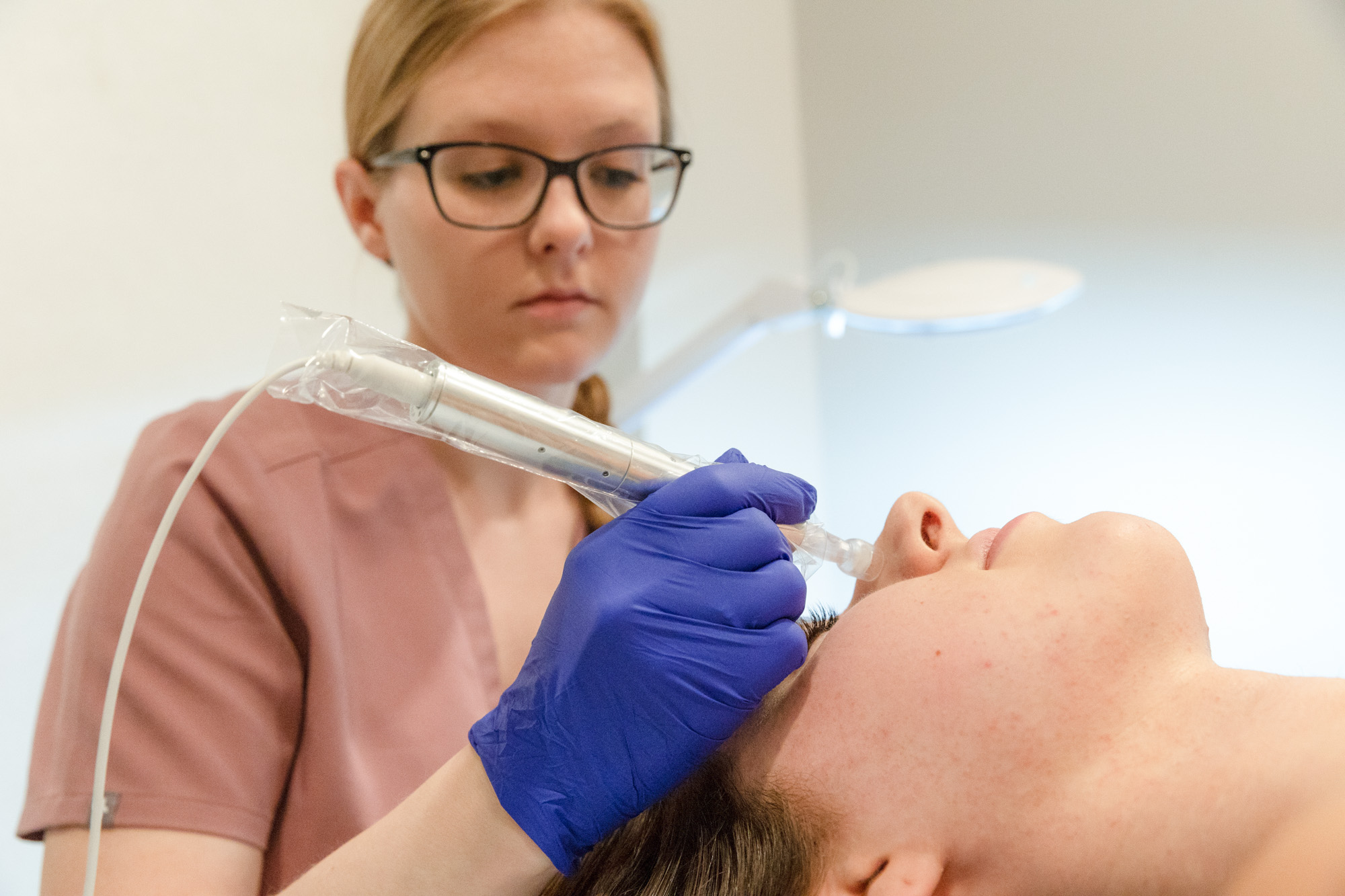 Microneedling