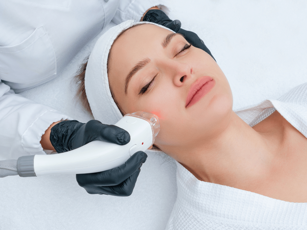 Laser Facials